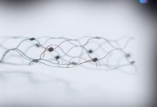 Photo of شريحة دماغ تجعل الأشخاص يتحكمون في جهاز الكمبيوتر بإشارات عقلهم