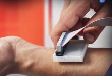 Photo of الذكاء الاصطناعي يحدد سرطان الجلد بدقة