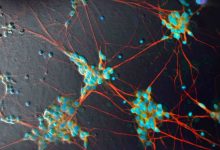 Photo of الخلايا الجذعية الدماغية تدعم الذكاء الاصطناعي