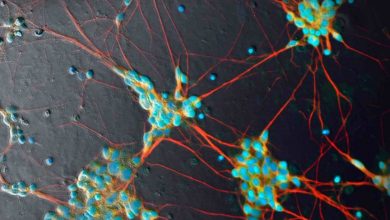 Photo of الخلايا الجذعية الدماغية تدعم الذكاء الاصطناعي